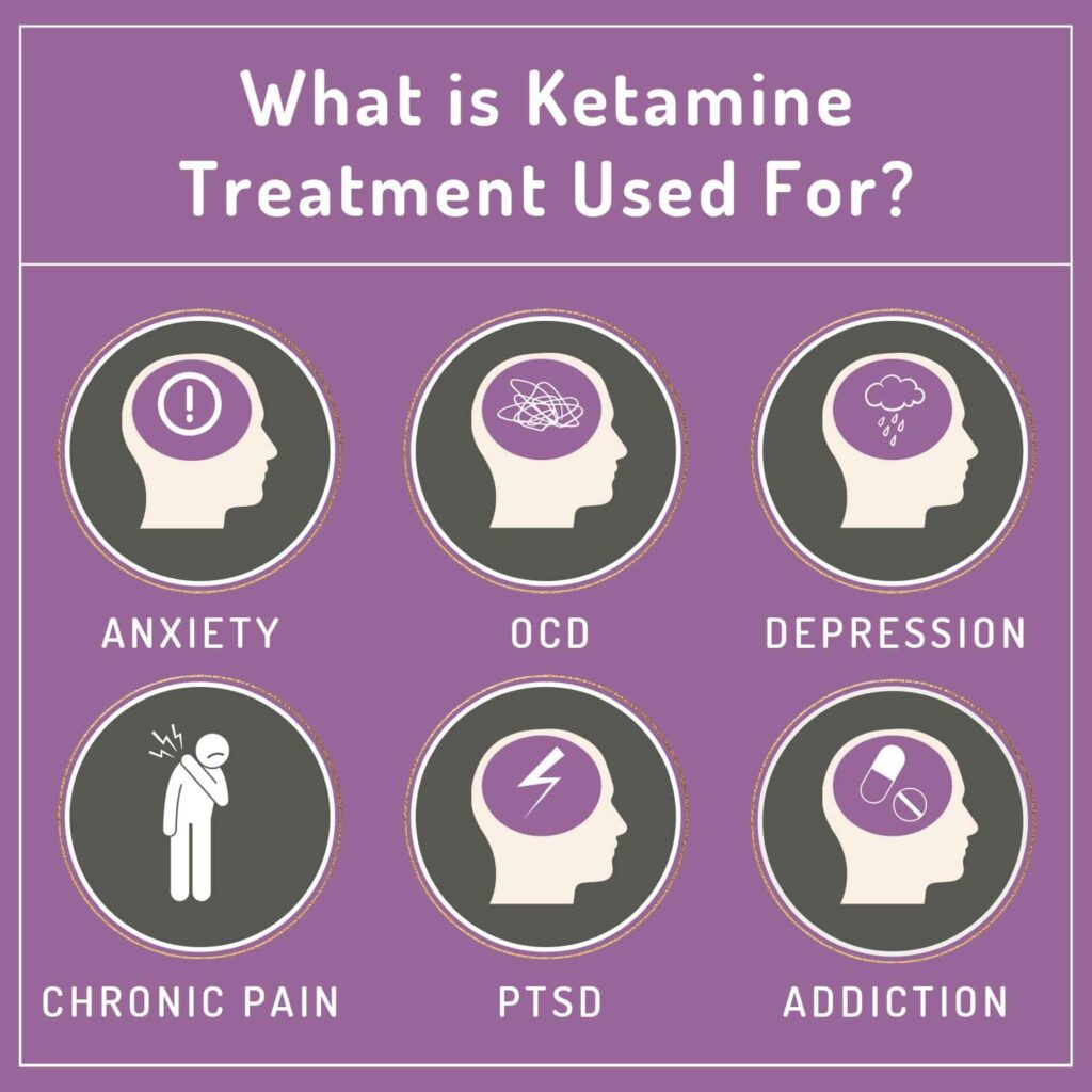 Ketamine Therapy North Portland
